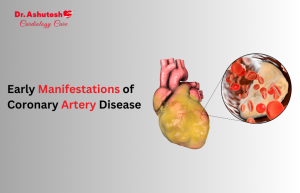 Artery Disease