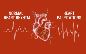 Heart Palpitations: Understanding the Causes and When to Seek Medical Advice