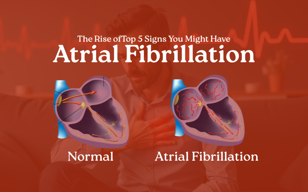 Top 5 Signs You Might Have Atrial Fibrillation—What Your Heart is Trying to Tell You