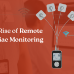 The Rise of Remote Cardiac Monitoring From Detection to Prediction: How Smart Heart Tech Is Growing Up