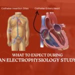 What to Expect During an Electrophysiology Study: Your Guide to the Procedure and Beyond