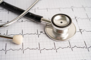 Why ‘Normal’ ECG Reports Don’t Always Mean Your Heart Is Safe