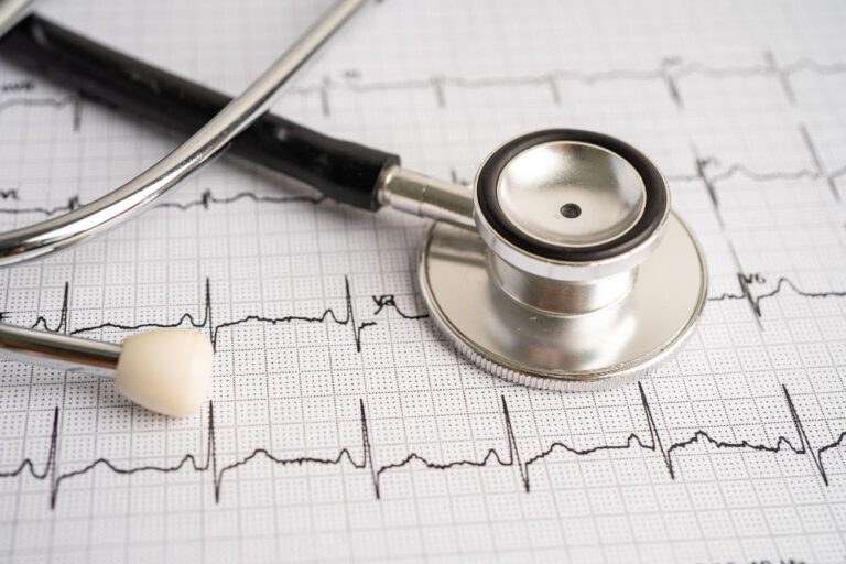 Why ‘Normal’ ECG Reports Don’t Always Mean Your Heart Is Safe