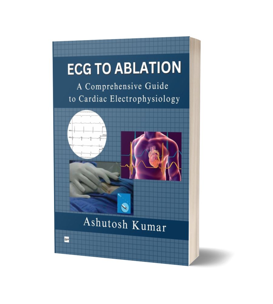ECG To Albation